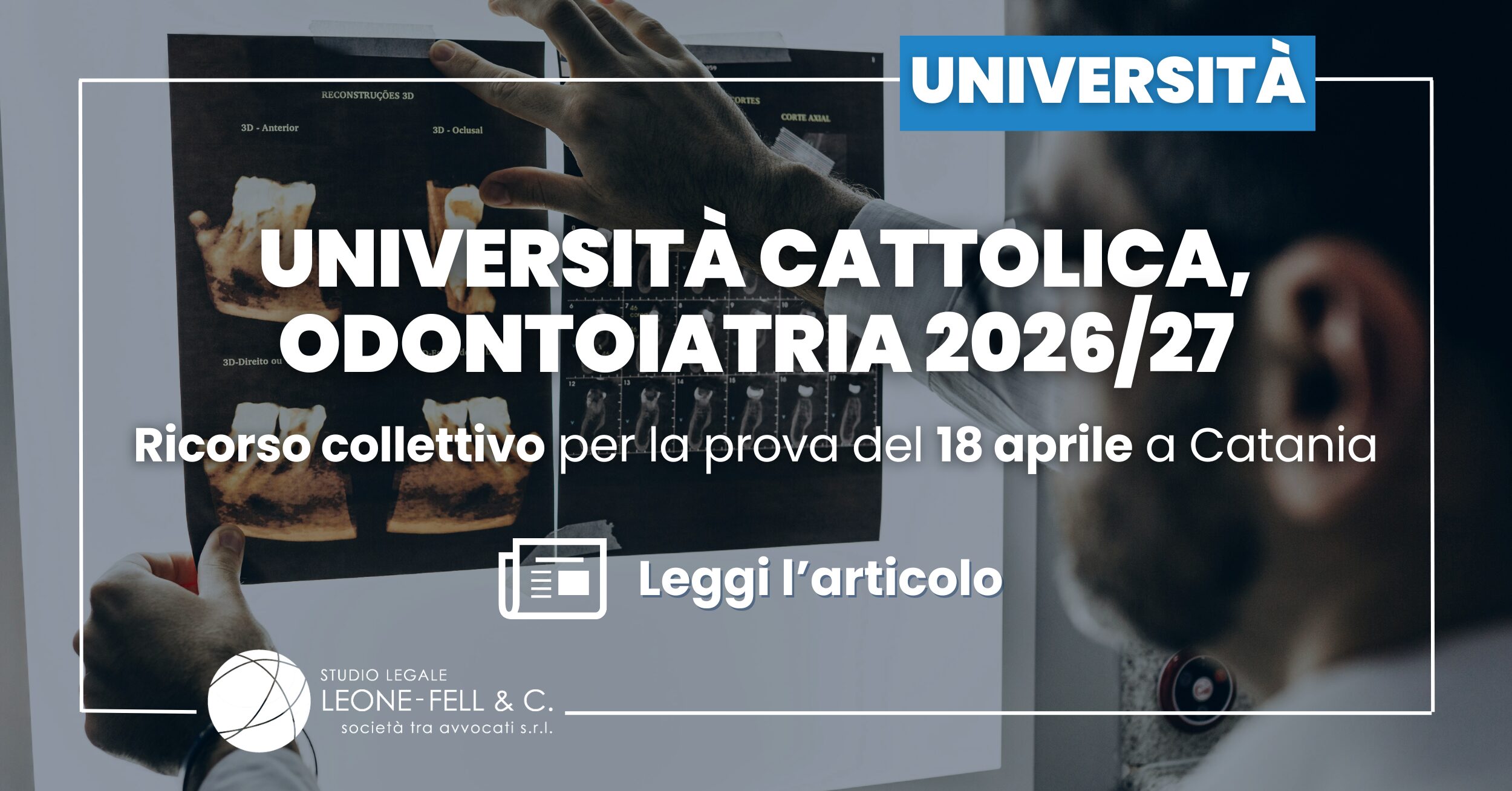Università Cattolica, Odontoiatria 2026/27: ricorso collettivo per la prova del 18 aprile a Catania